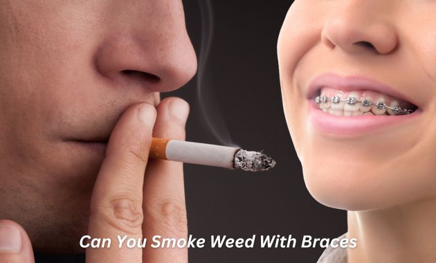 Can You Smoke Weed With Braces