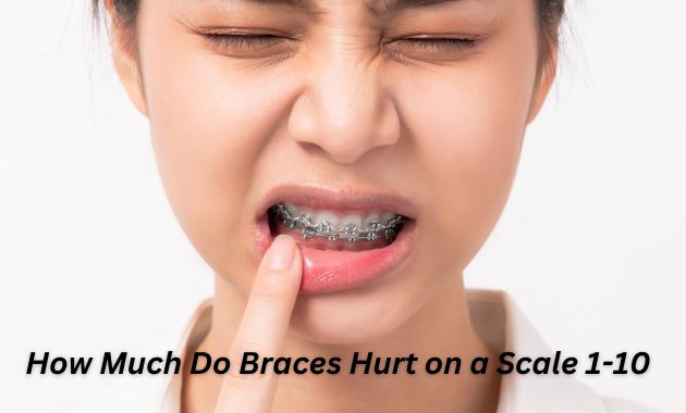 How Much Do Braces Hurt on a Scale 1-10