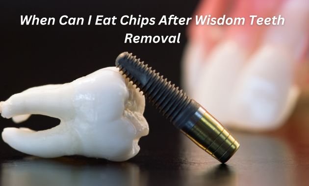 When Can I Eat Chips After Wisdom Teeth Removal
